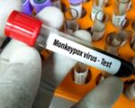 Екіпаж суховантажа на карантині в Аргентині через підозру на мавпячу віспу